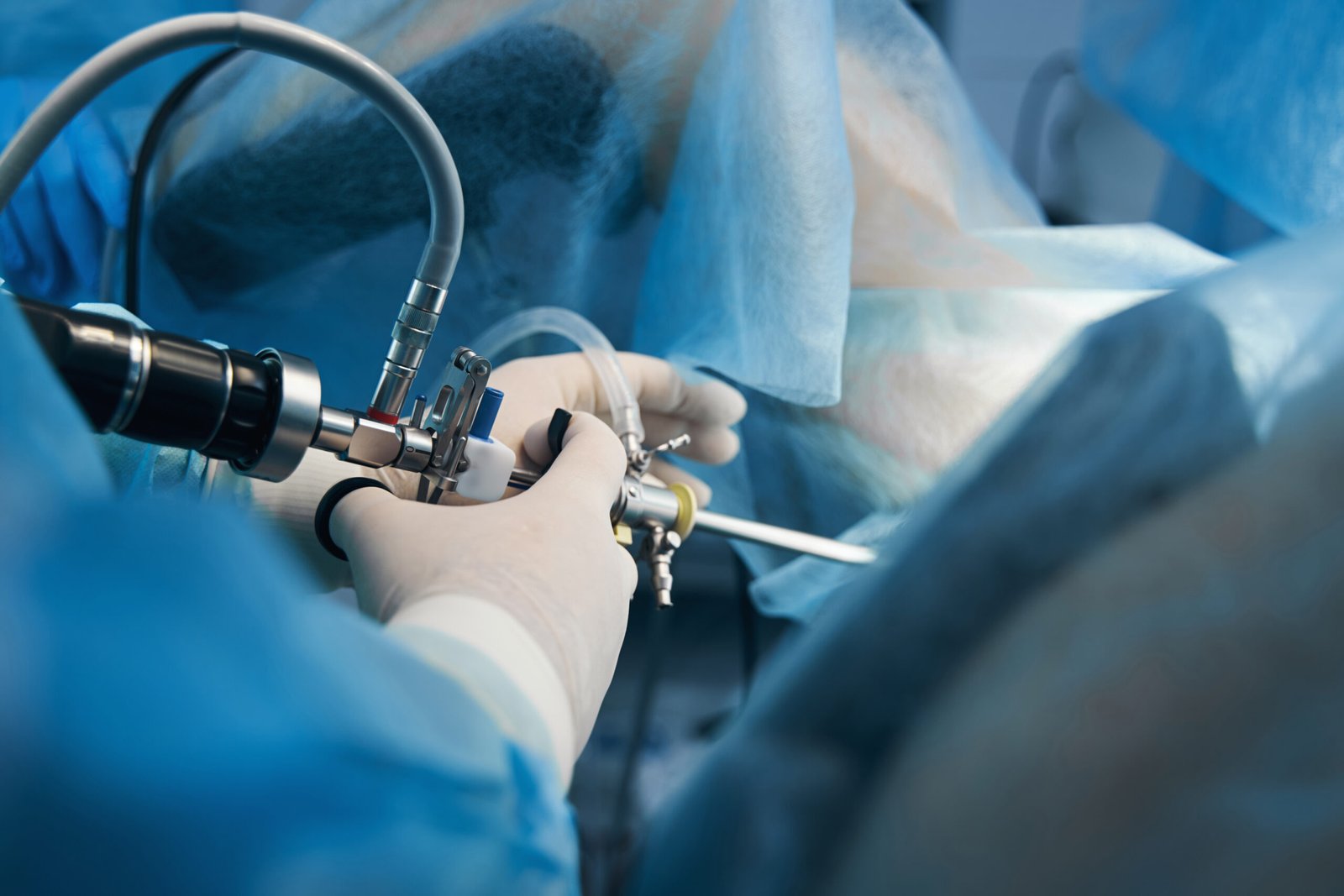 Laparoscopy for Female Infertility: Diagnosis & Treatment
